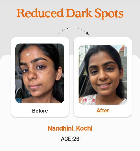 Vitamin C Daily Glow Combo