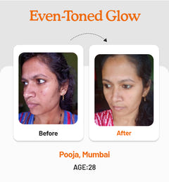 Vitamin C Daily Glow Combo