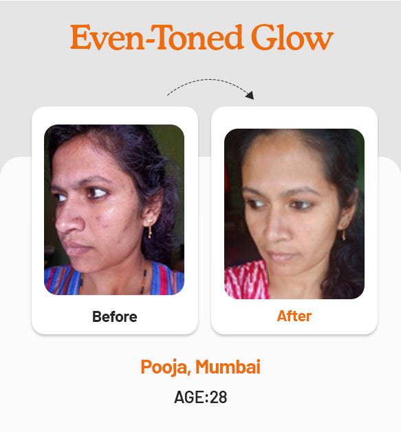 Vitamin C Daily Glow Combo