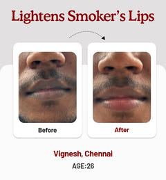 Beetroot Lip Balm