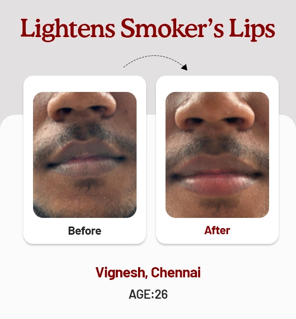 Beetroot Lip Balm