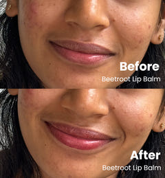 Nourished Lips Combo