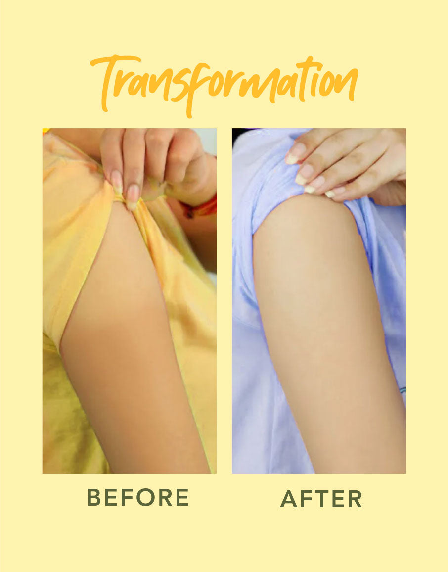 deyga De-Tan & Anti-Pigmentation Combo transformation