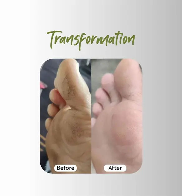 Foot Butter 40g