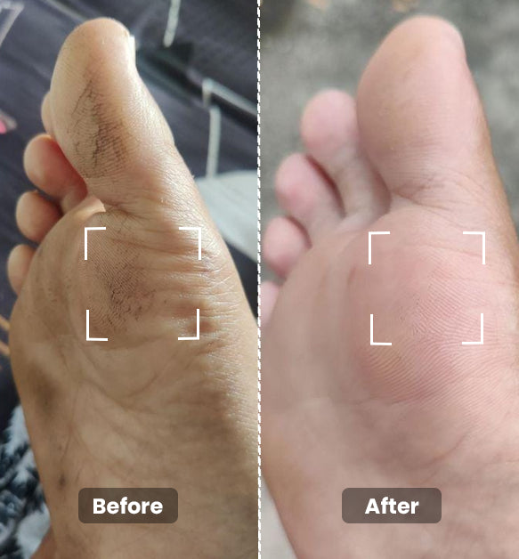 Foot Butter 40g