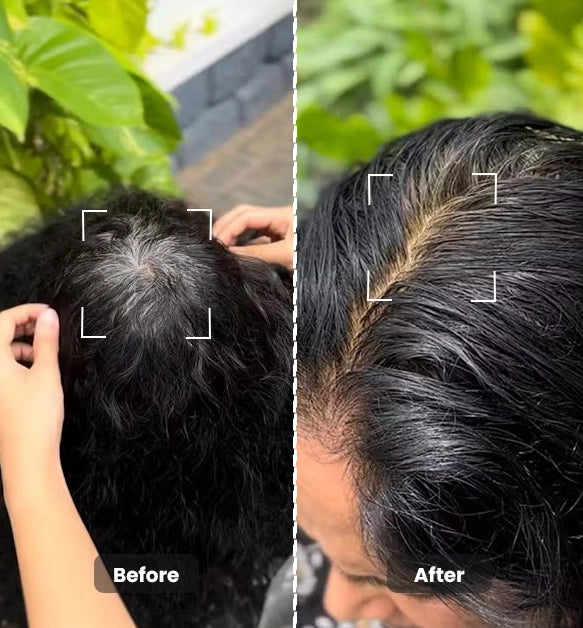 Premature Greying Oil