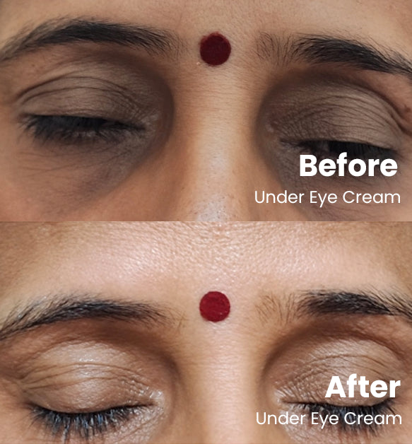 Under Eye Cream 15g