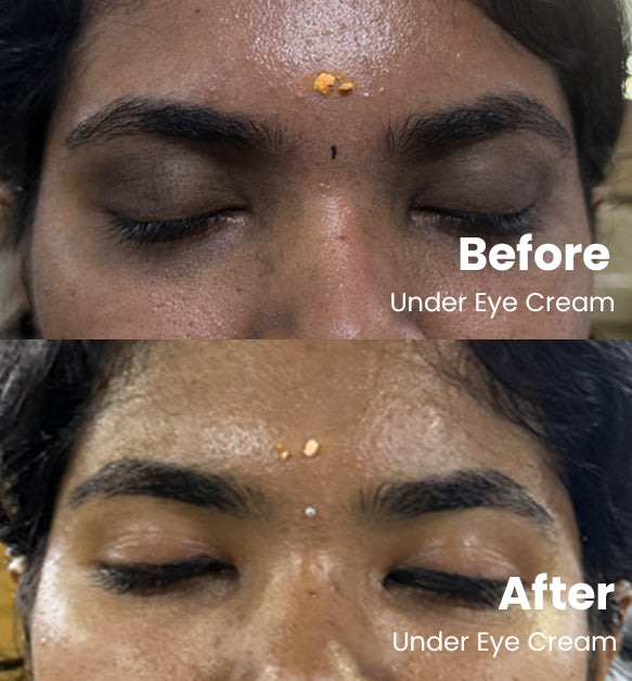 Under Eye Cream 15g
